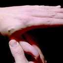RFID Implants