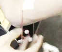 Myolectric Sensor